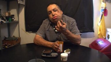 UC San Diego Doctor Uses Cannabis To Treat Pain